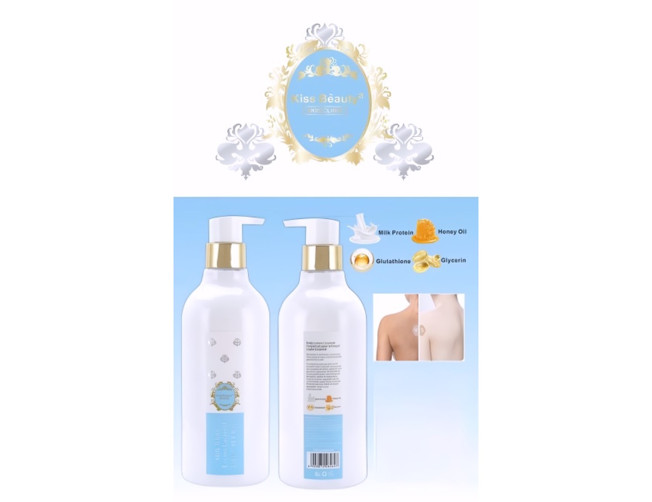 Sugerir miniatura de producto